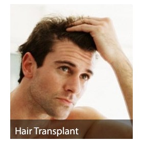 Best Hair Transplant cost offered: Solution of baldness problem